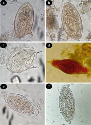  Tetrabothrius! A Trematode Master of Deception Hiding Within a Herd